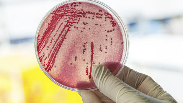 Petri dish with red bacteria, lab work