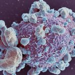 Artificial Intelligence and Cancer