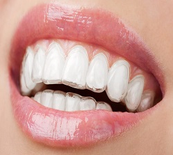 Teeth Whitening Strips Market